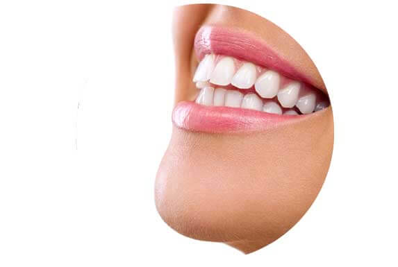 Teeth whitening by Karina Mattaliano and associates dental clinic